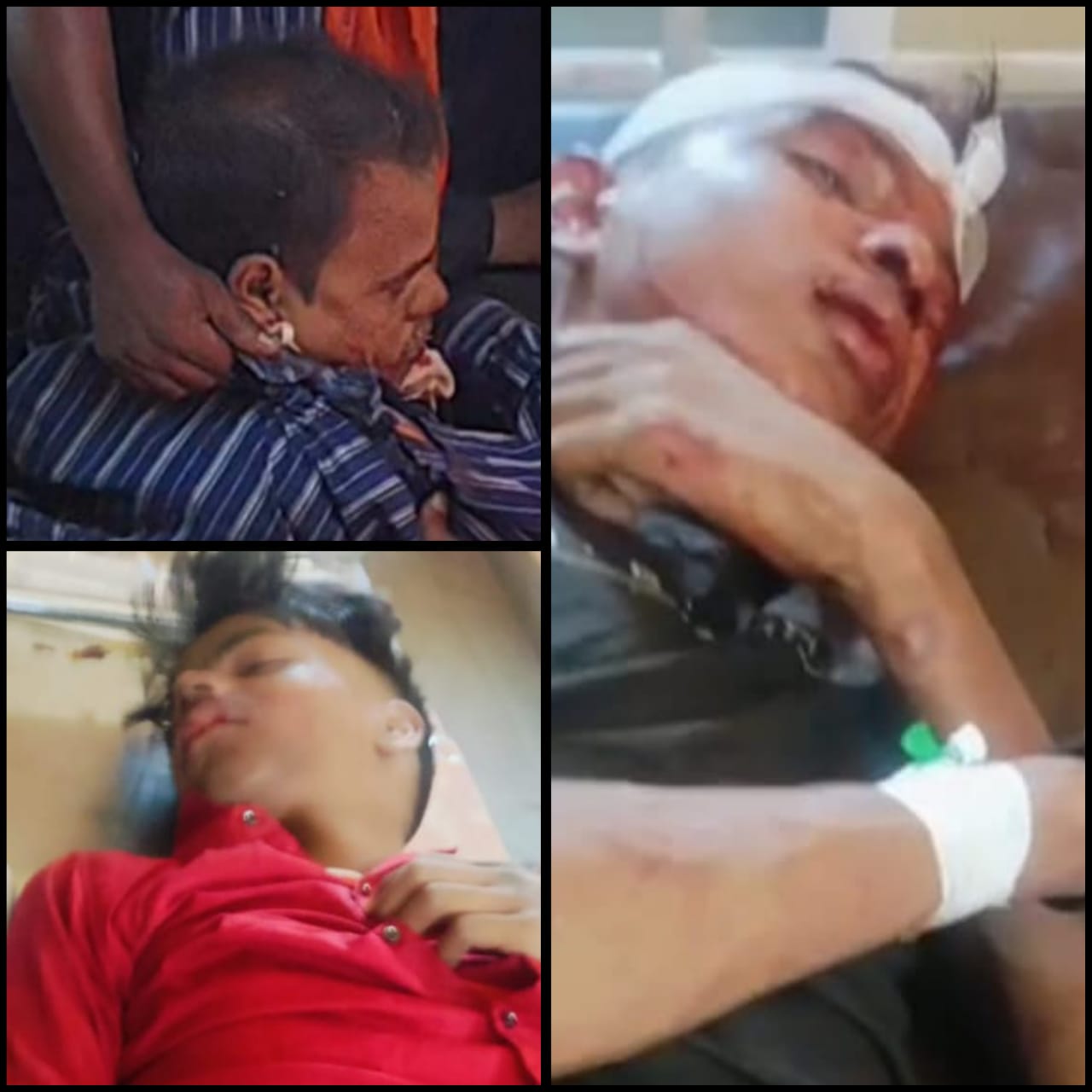 सड़क हादसे में नाबालिग घायल, निजी नर्सिंग होम में भर्ती